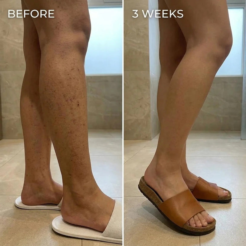 Cyperus Rotundus Skin Serum - Stop Unwanted Hair Growth Naturally - [Buy 1 Get 1 Free]